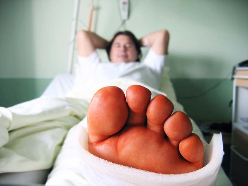 man with broken leg in hospital