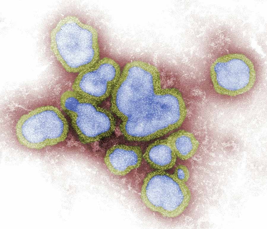 electron microscopic image depicting the flu virus (Influenza A virions)
